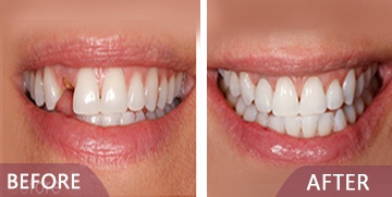 dental surgery before after